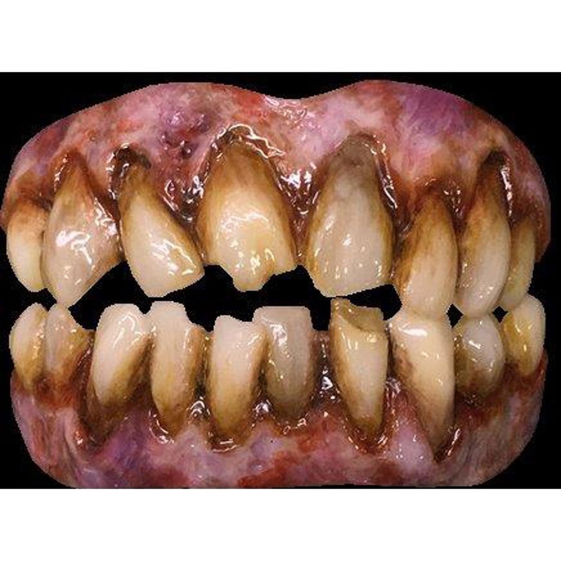 Zombie Teeth By Trick Or Treat Studios
